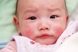 Bí quyết bảo vệ các vấn đề về da cho trẻ sơ sinh mùa lạnh